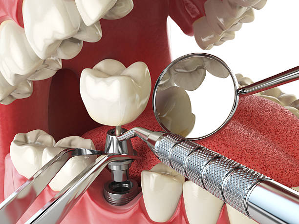 Best Cosmetic Emergency Dentistry in Wisr, NE